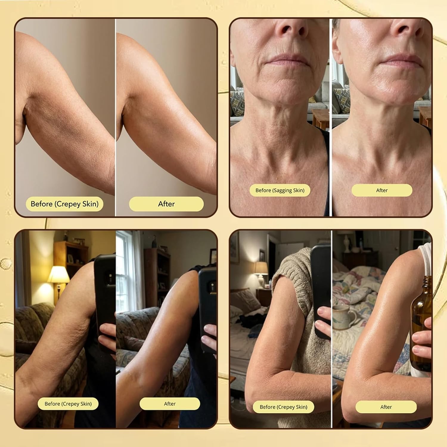 Erae Queen Oil – Face Body Oil for Crepey Skin, Restores Lipid Barrier, Firm…