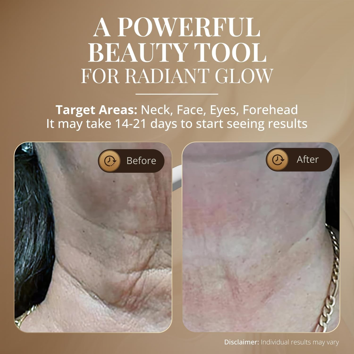 Red Light Face & Neck Beauty Device – Skin Revitalization