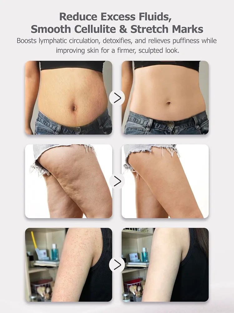 Lymphatic Drainage Massager & Anti Cellulite Massage Tool Reduce Stretch Marks