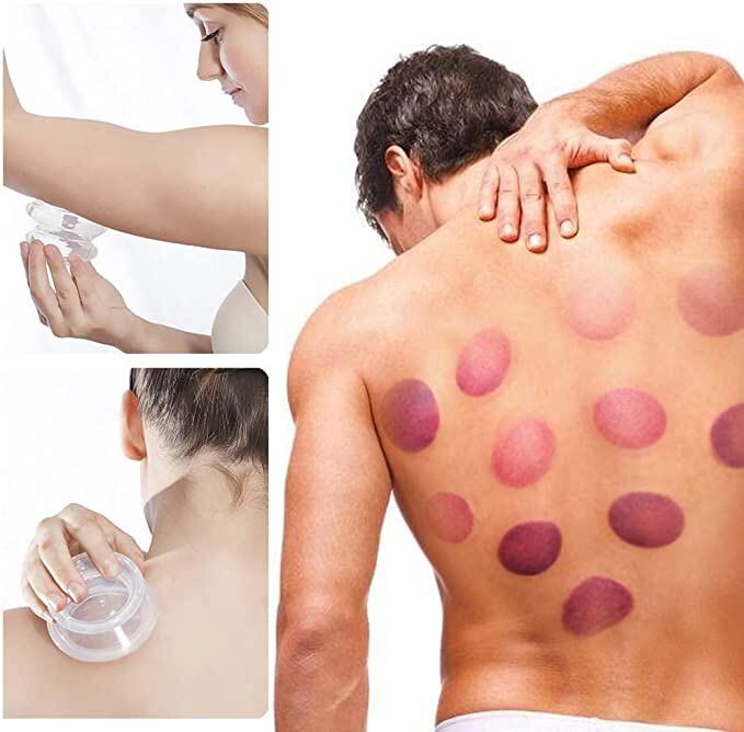 Pain Relief Cupping Therapy Set Silicone Neck Face Body Massage Vacuum 2-5 Cups