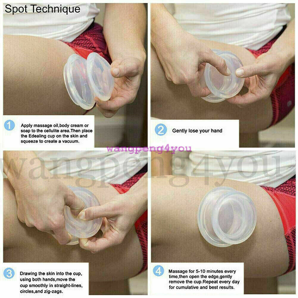 Advanced Chinese Silicone Massage Cups Cupping THERAPY Set Cupping Massage Jar