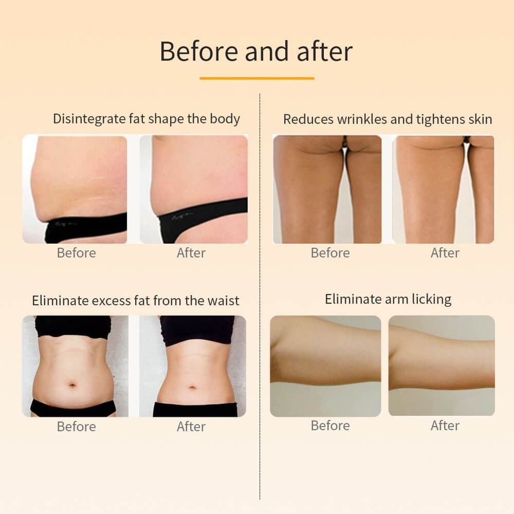 RF Radio Frequency Body Slimming Machine Cellulite Massager Fat Burner Shaping