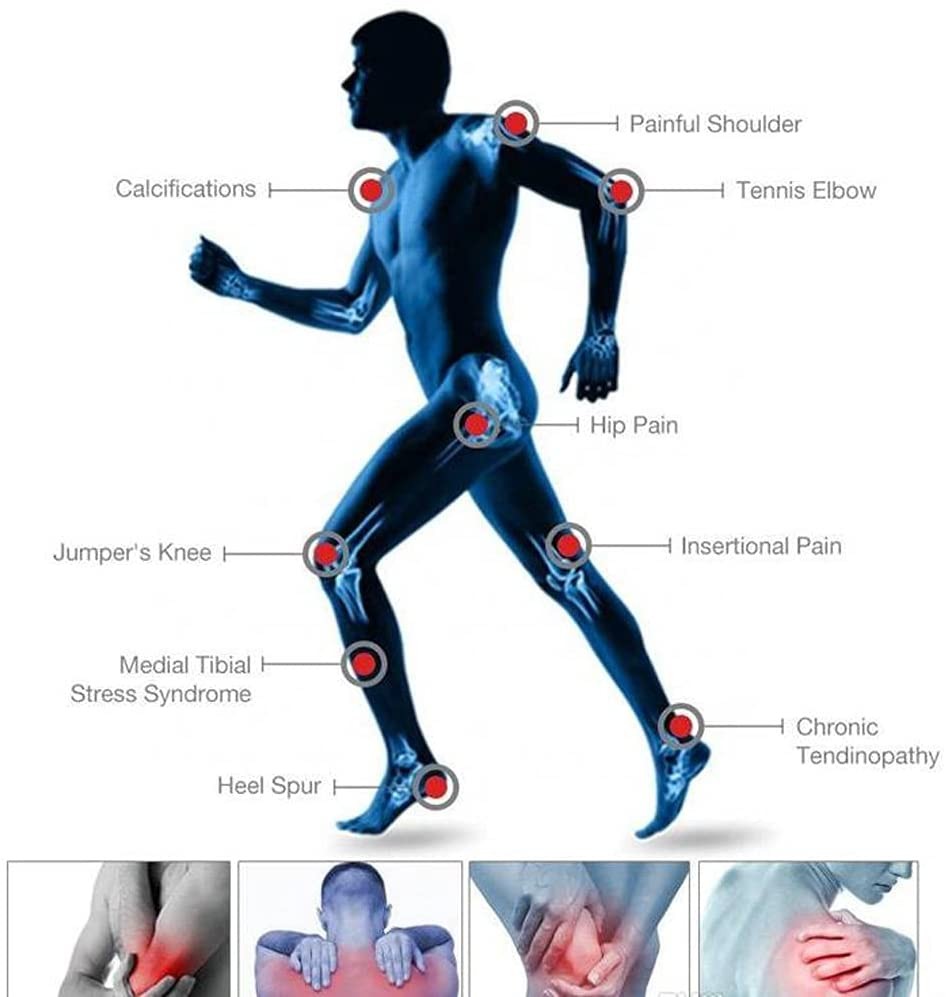 ESWT Focused Shockwave Therapy Machine Relieve Muscle Pain ED Treatment Handheld