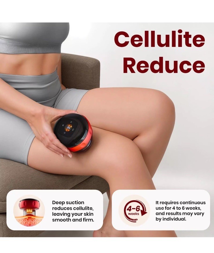 5-in-1 Smart Dynamic Cupping Therapy Set with Red Light Cupping Kit for Massa…