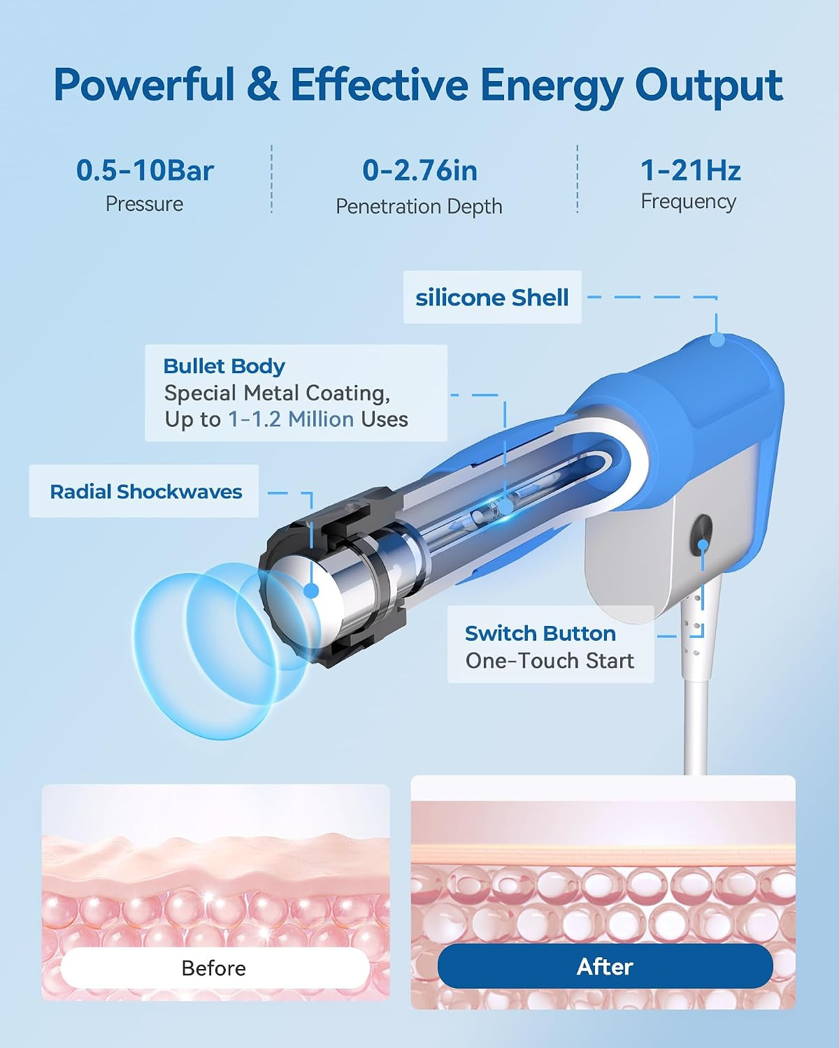 SV Shockwave Therapy Machine, Extracorporeal Shock Wave Device with 0.5–10 Bar,