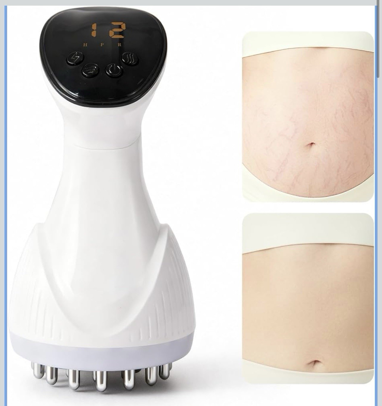 Anti-Cellulite Massage Tool, Body Contouring Device for Legs, Arms & Stomach,