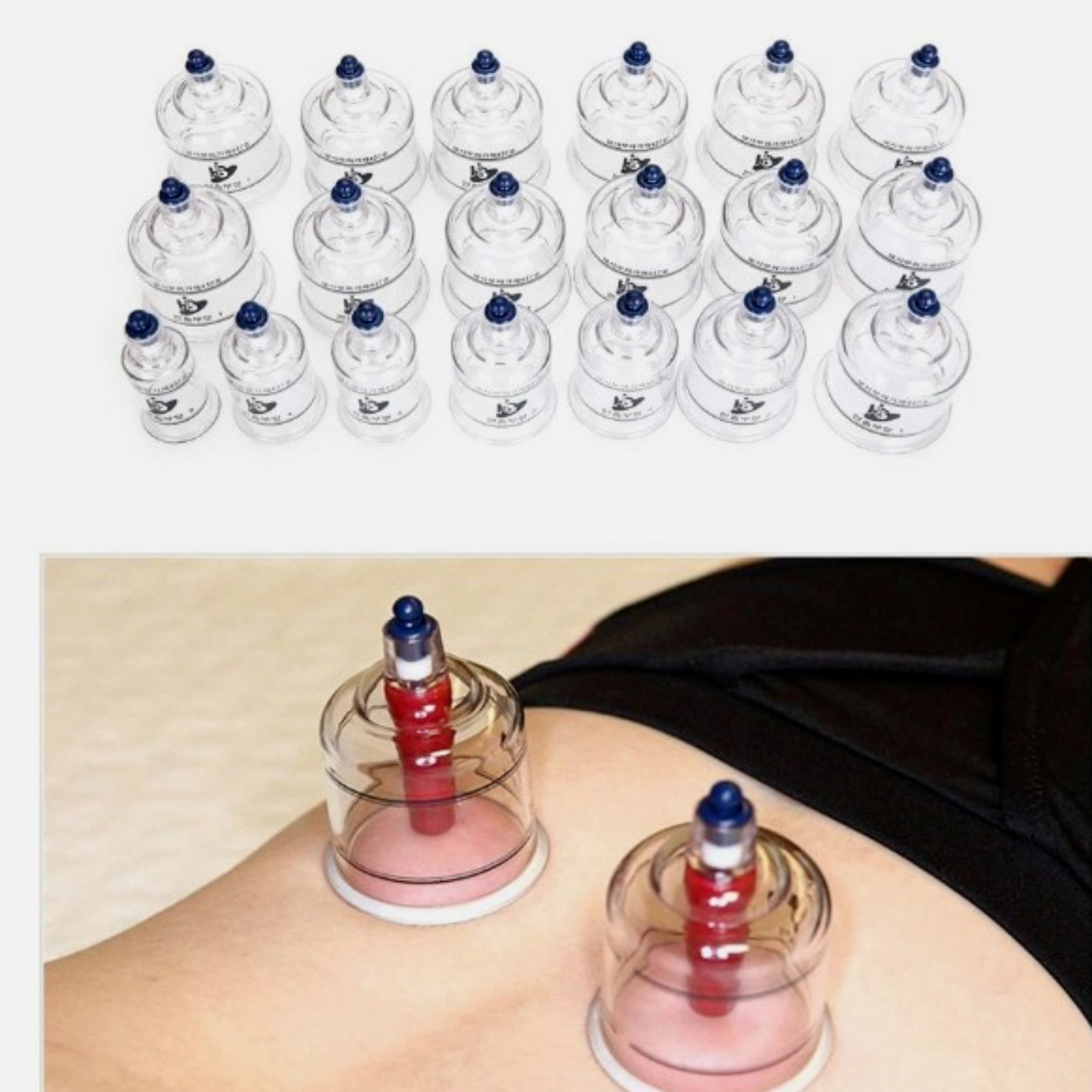 Hansol Professional Cupping Therapy Set 19 Cups Pump Handle Made in Korea