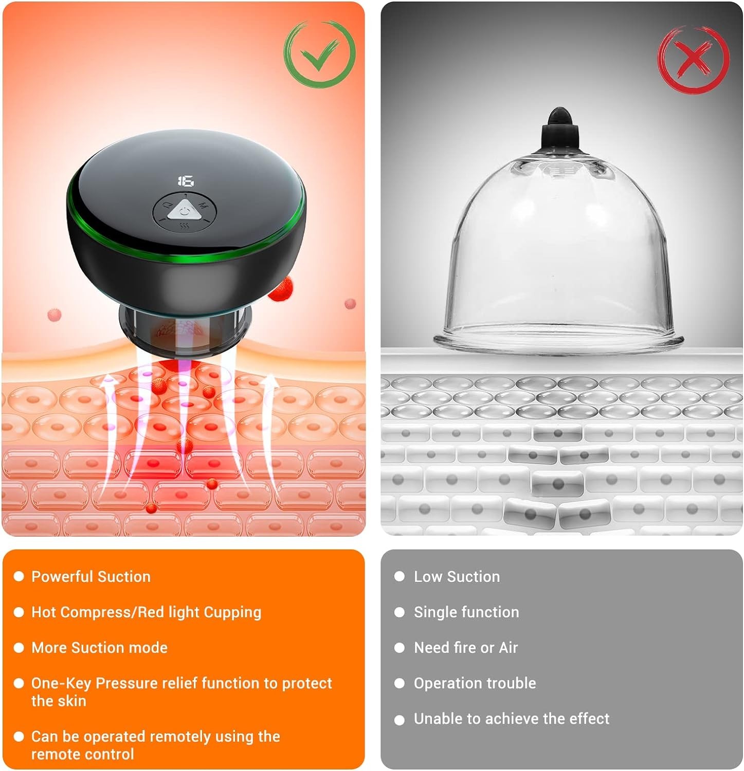 16-Level Smart Electric Cupping Therapy Set with Red Light & Remote Control USB