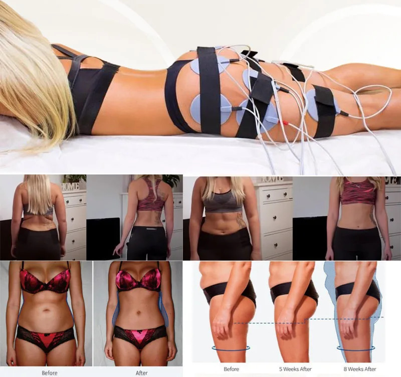 Pressotherapy Air Pressure Lymphatic Drainage Device Infrared Body Slimming Suit