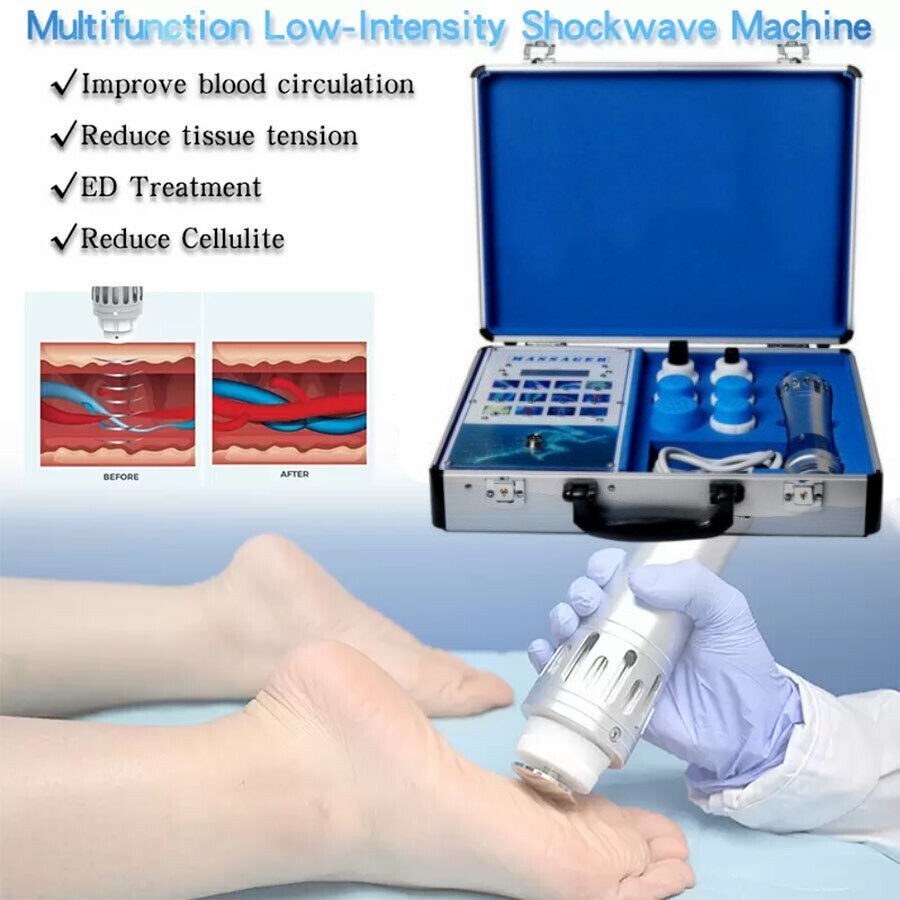 ED Therapy Shock Wave Machine Shoulder Wrist Pain Treatment Shockwave Device
