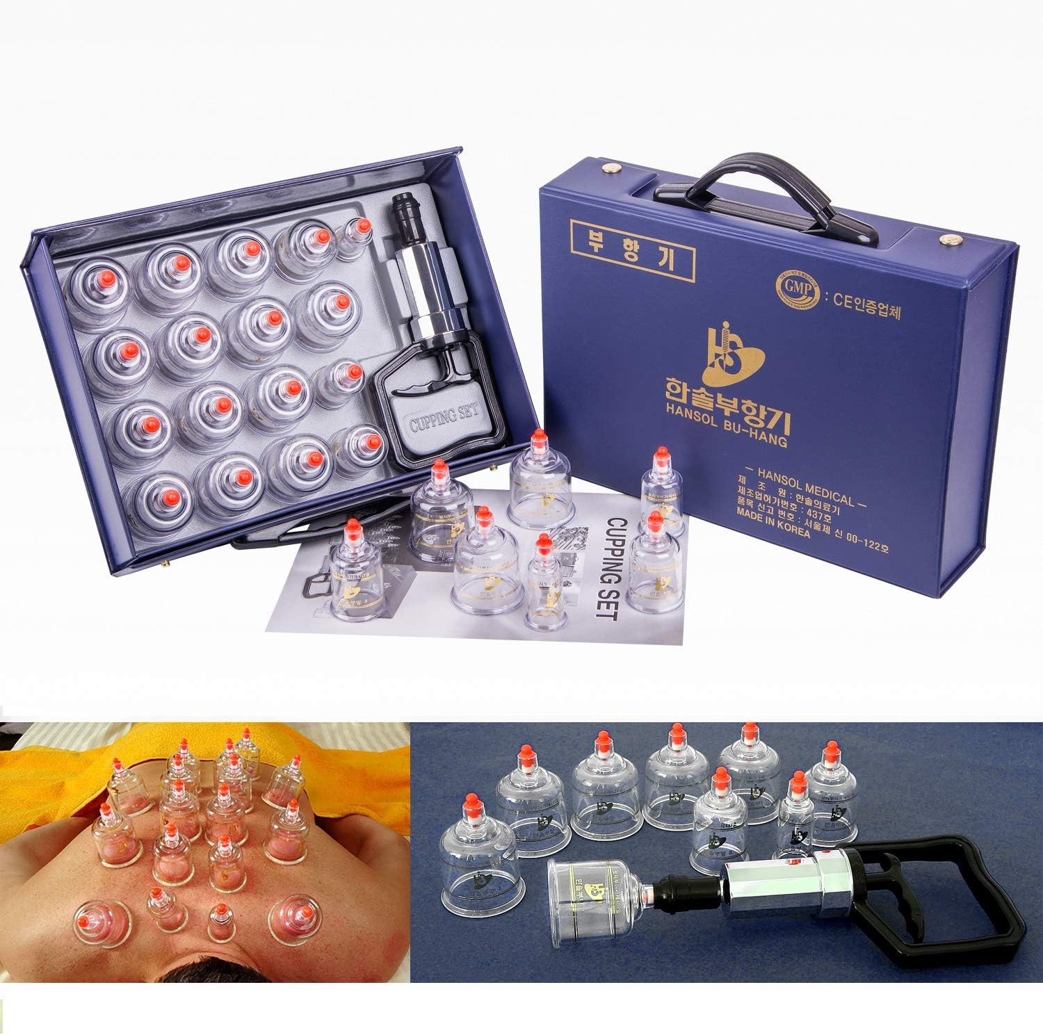 Cupping Therapy Equipment Set with Pumping Handle 17 Cups Made in Korea