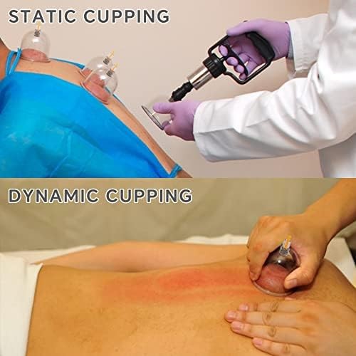 Cupping Kit for Massage Therapy Set with Pump 12 Massage Cups for Cellulite Redu