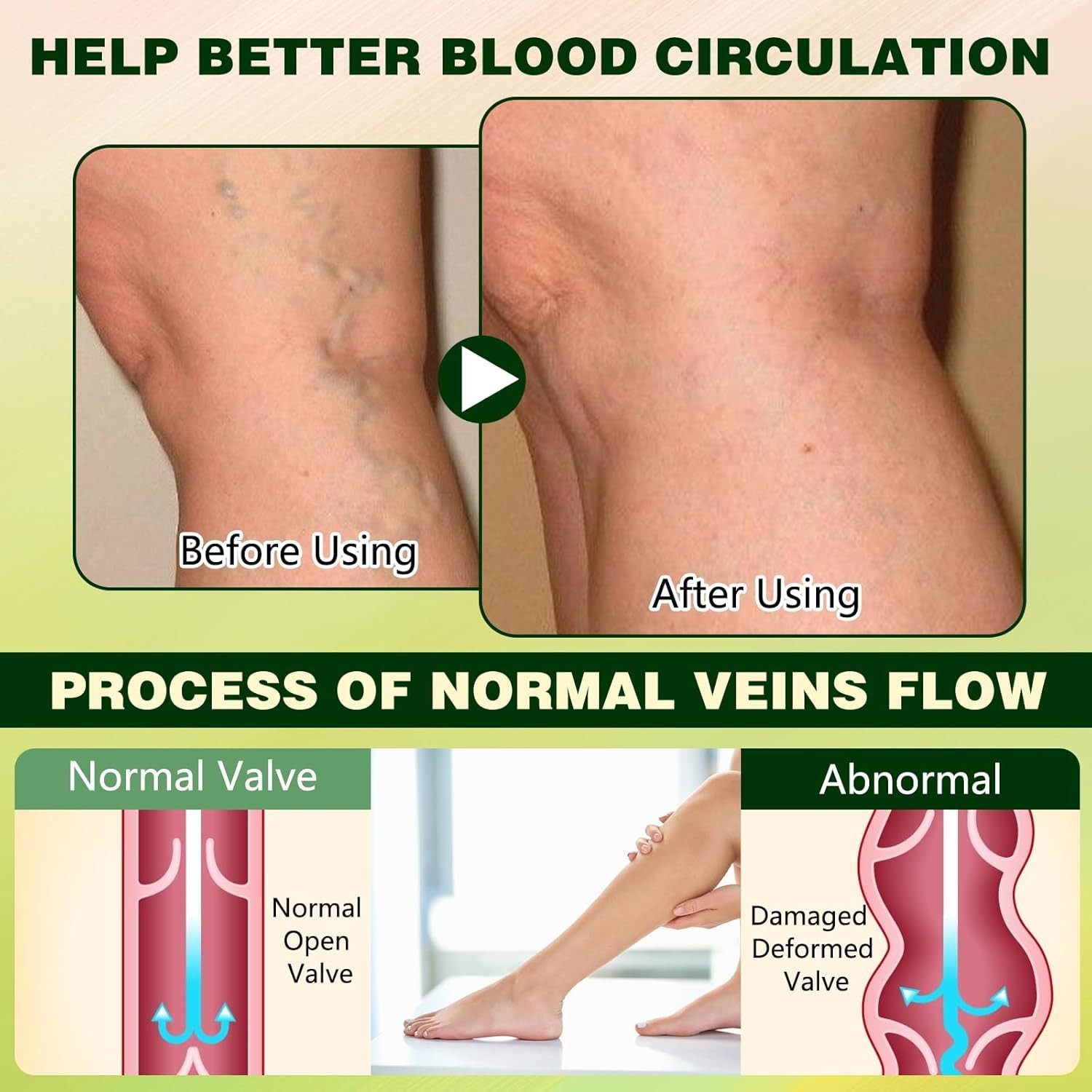 Herbal Leg Circulation Cream – Quick Absorbing Formula for Daily Comfort (100ml)
