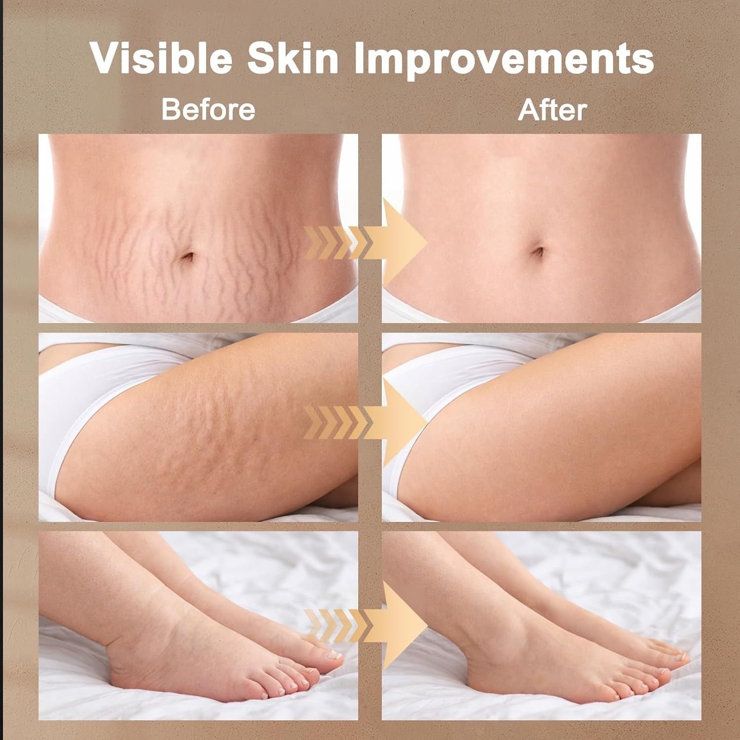 5-in-1 Lymphatic Drainage Massager: Reduce Cellulite with Microcurrent & Heat