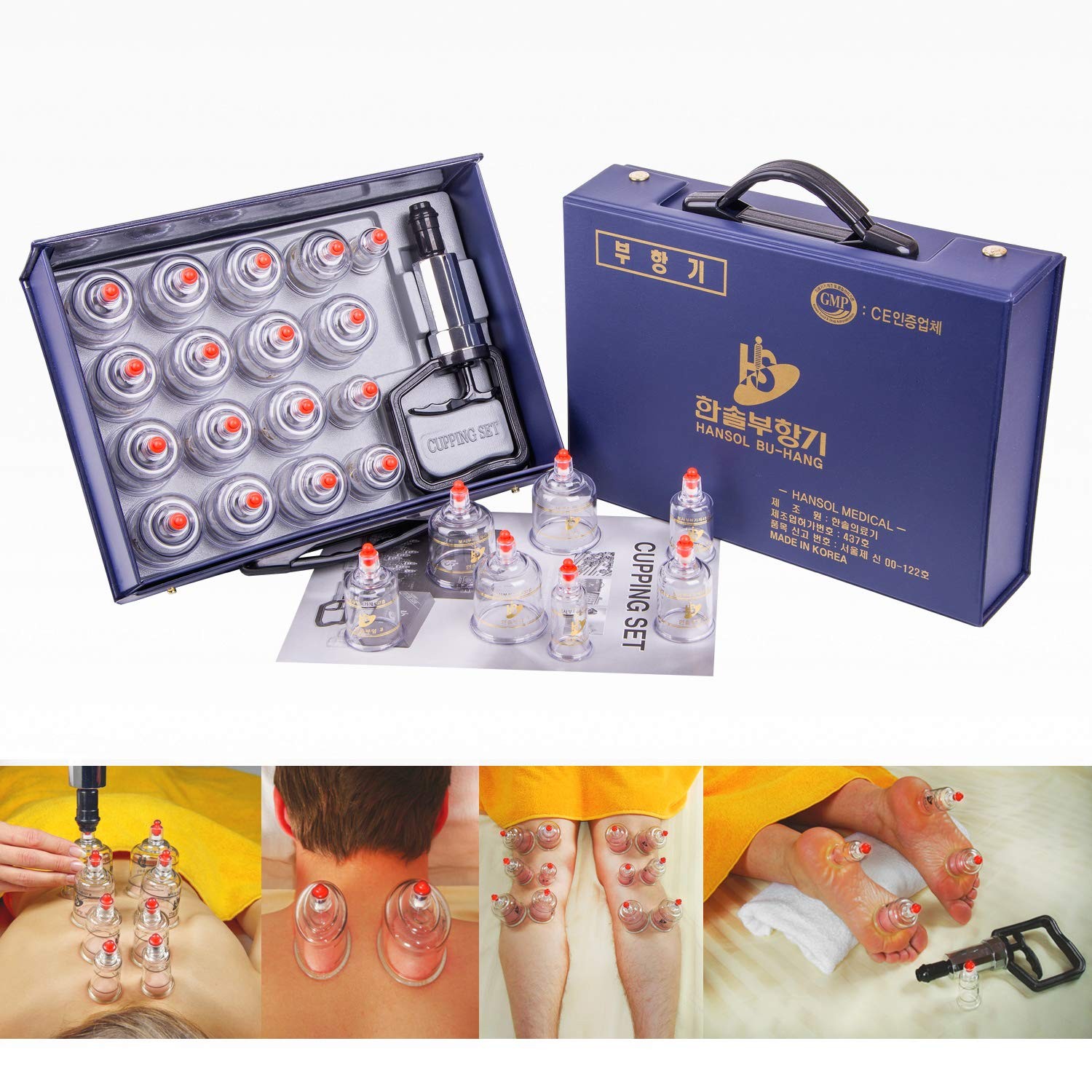 Cupping Therapy Equipment Set with Pumping Handle 17 Cups (Made in Korea)