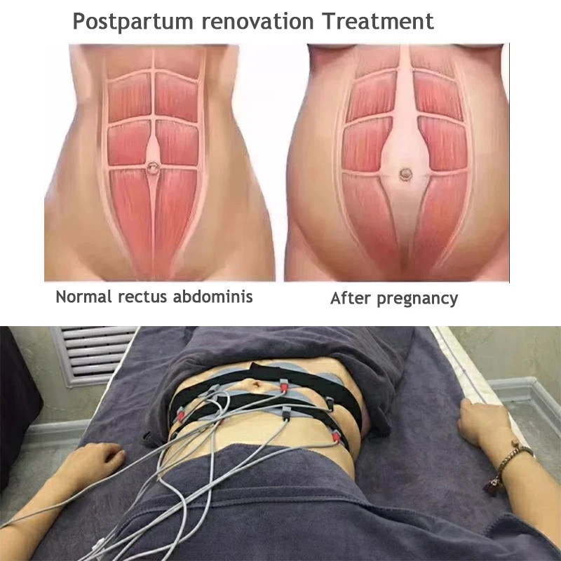 Pressotherapy Air Pressure Lymphatic Drainage Device Infrared Body Slimming Suit