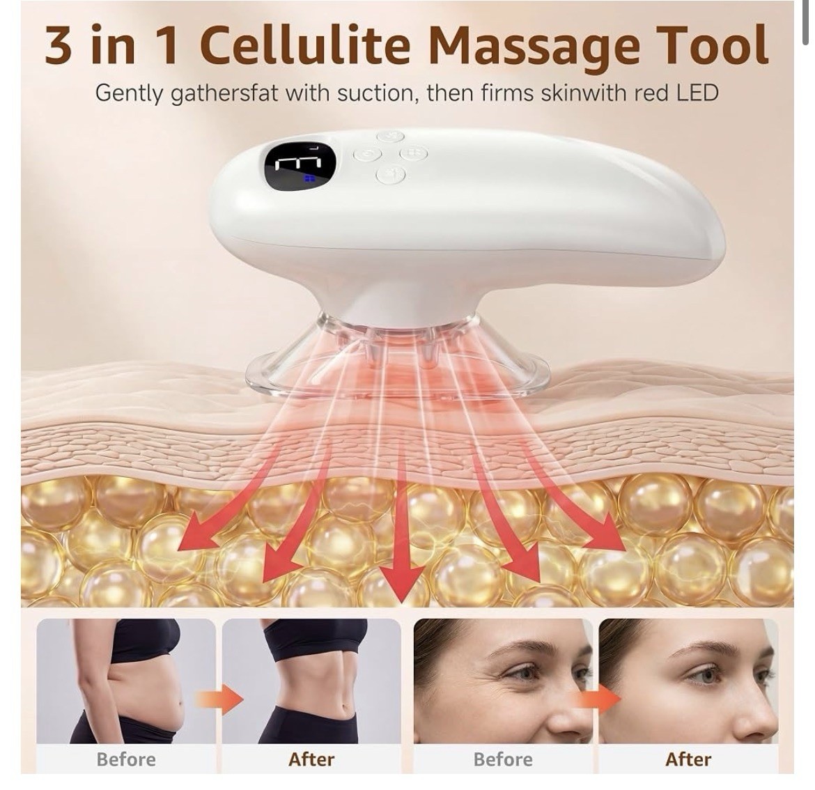 Graise YS-668 3-in-1 Anti-Cellulite Suction Massager Cordless LED USB White