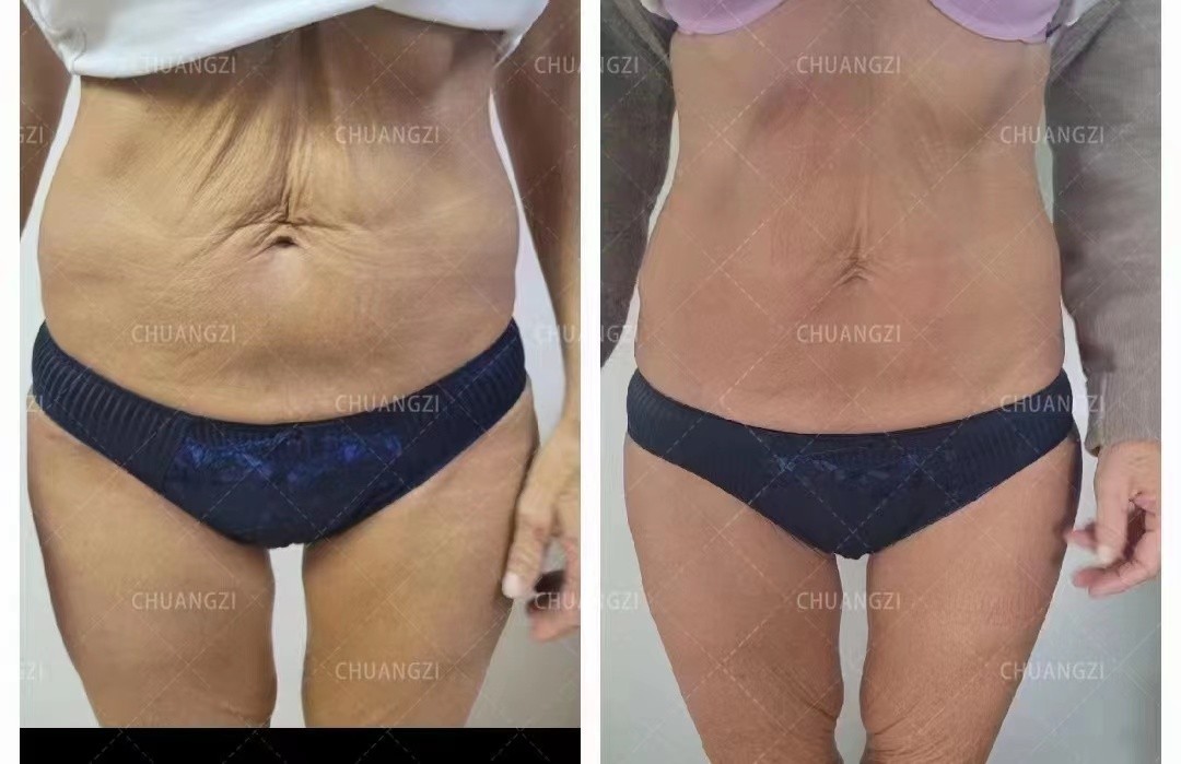 2026 TAIXL Body Shaping Fat Removal Build Muscles Body Sculpt Salon Machine