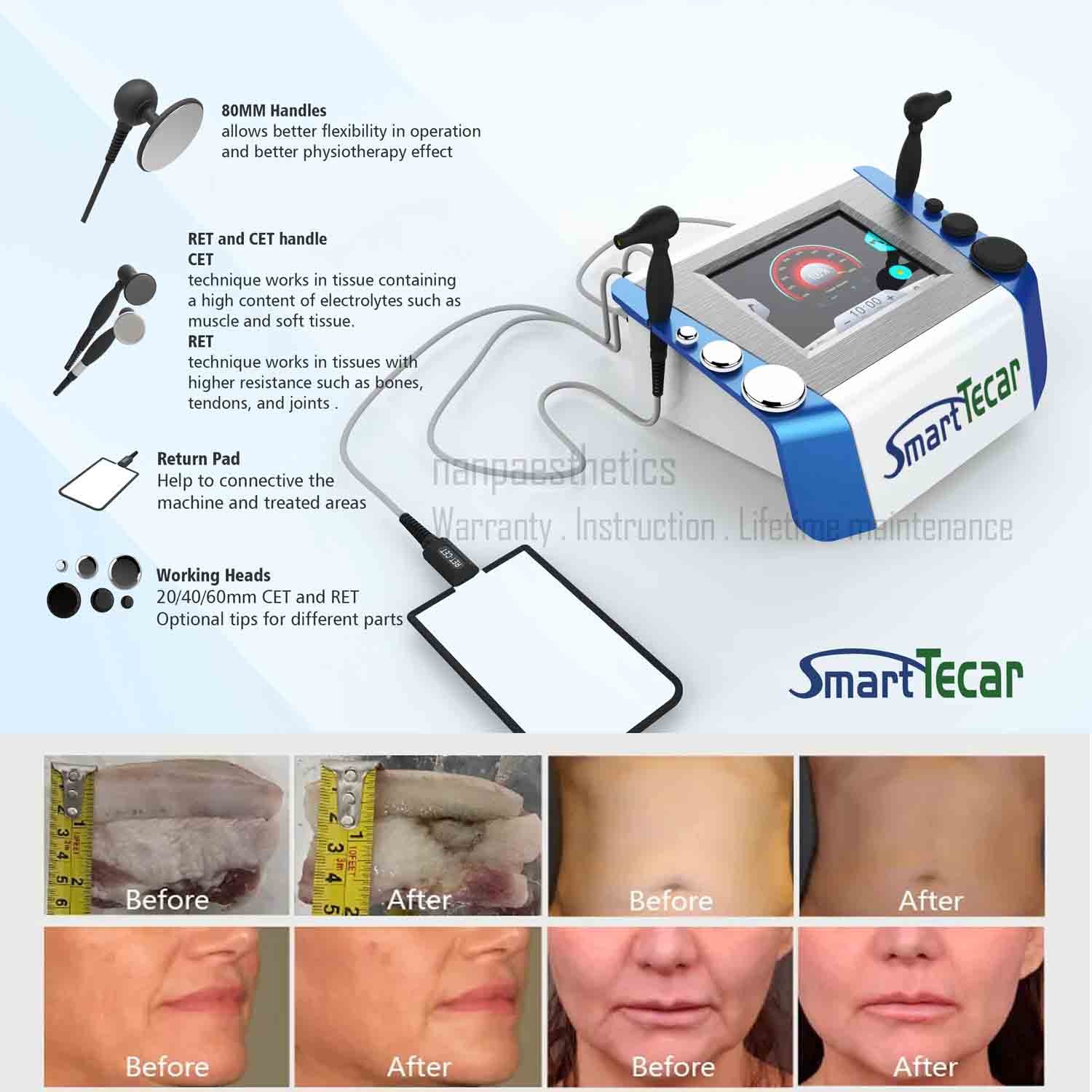 Professional Smart Tecar Therapy Machine CET RET Face Lift Body Slim Pain Relief