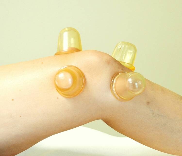 Set of 8 Silicone Cupping Body Cups Anti Cellulite Tension Circulation Massage