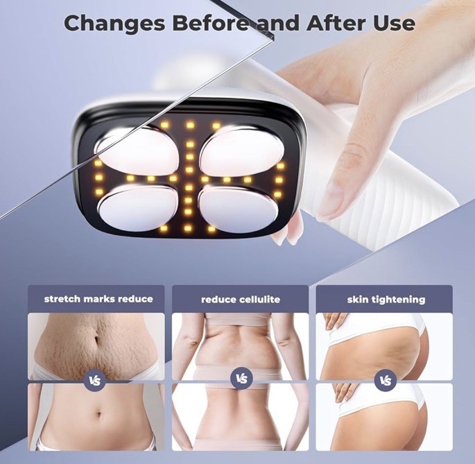 Depsoul Cellulite Massager – NEW- FREE SHIPPING