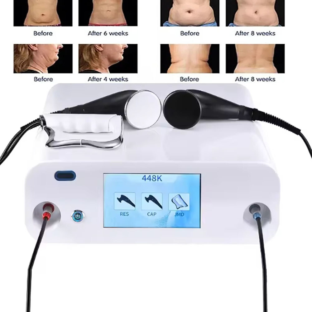 Fever Master 448KHZ Tecar Therapy Machine RET CET Diathermy Pain Relief Massager