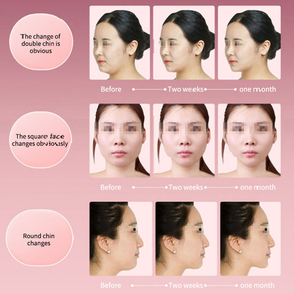 Facial Lift Device Photon Therapy Facial Slimming Vibration Massager V Face