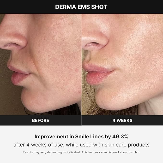 1Pcs Face Skin Tightening Massage Beauty Machine Anti-Wrinkle Anti-Aging Device