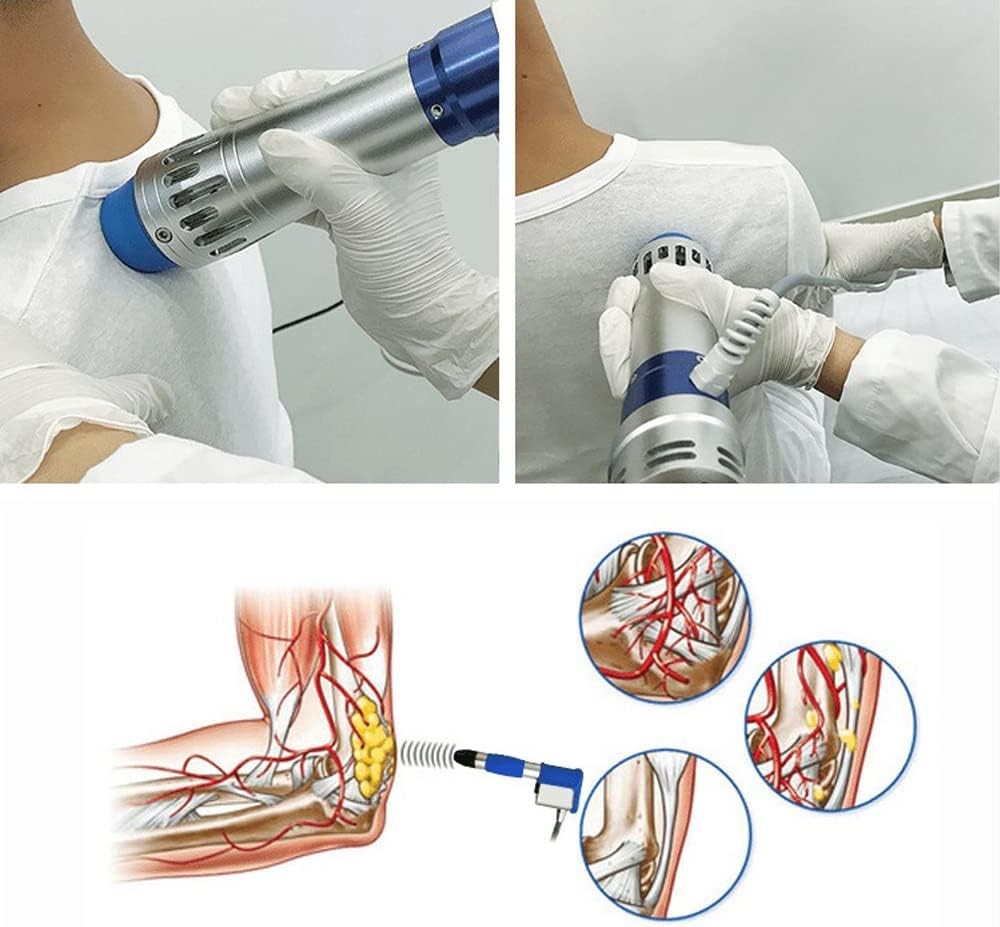 SW14B Shockwave Therapy Machine Portable Pain Relief Tool