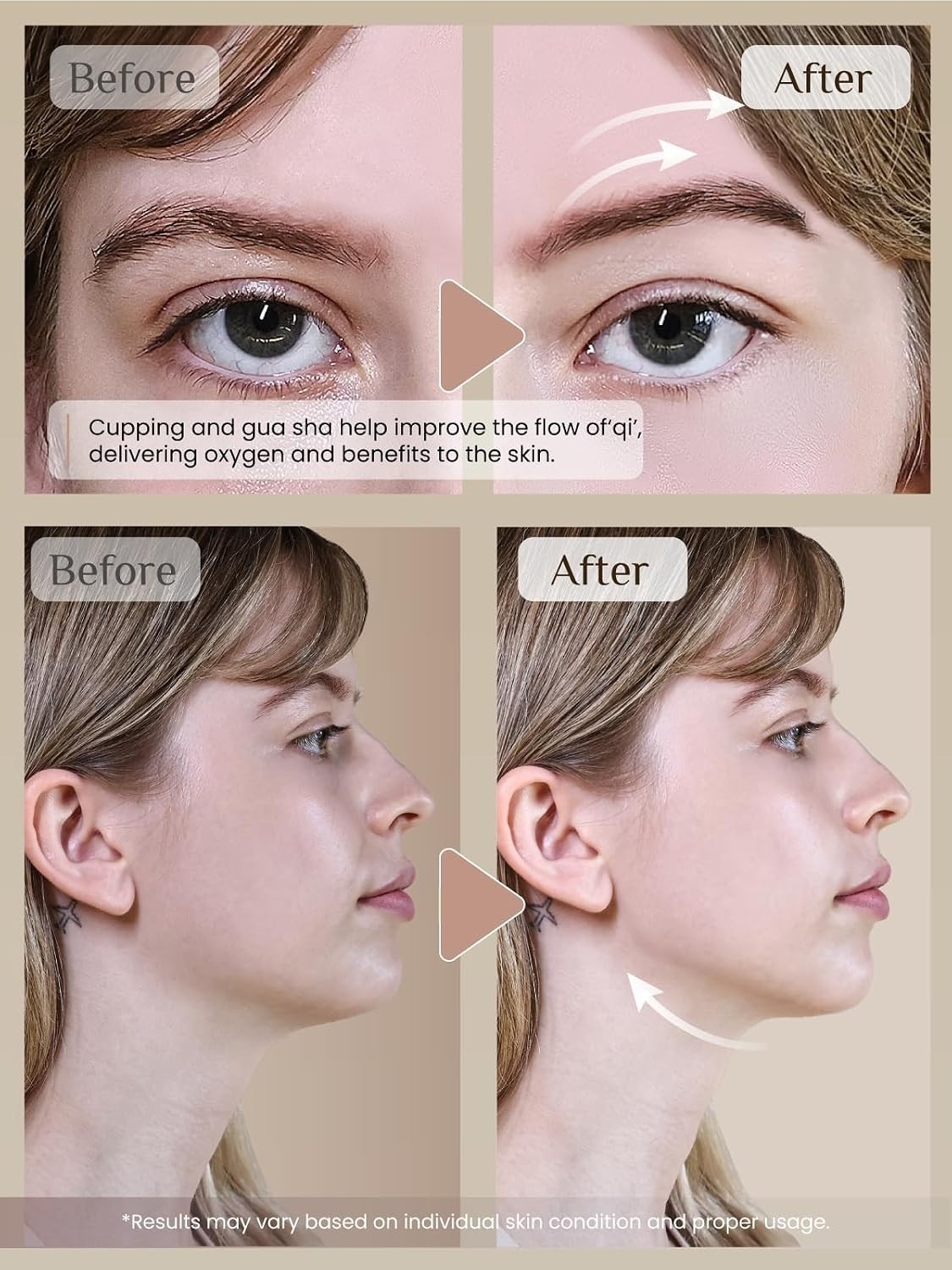 Rena Chris Facial Cupping & Gua Sha Set – Natural Skin Rejuvenation with Rose…
