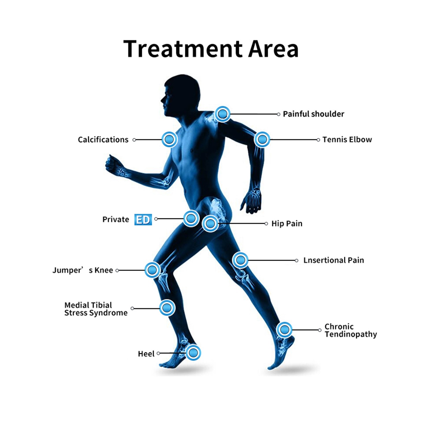 Touch screen Pneumatic Shockwave Therapy Machine For Pain Relief ED Treatment