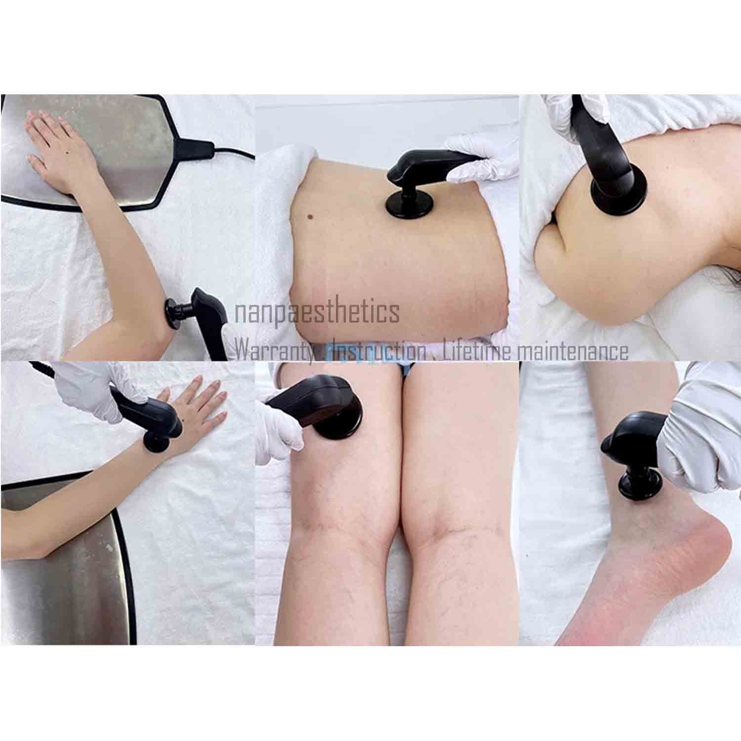 Smart Tecar Therapy Machine CET RET Pain Relief Sports Injury Facial Skin Care