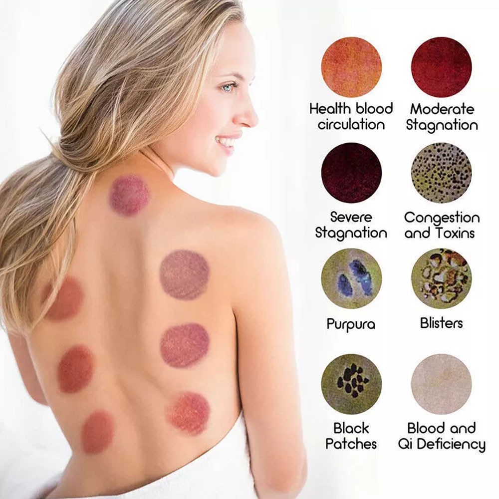Electric Cupping Therapy Set with Red Light Smart Cupping Gua Sha Massage Device