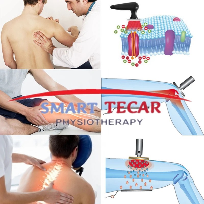Smart Tecar Therapy Machine Cet Ret Pain Relief Physiotherapy Reduce Cellulite
