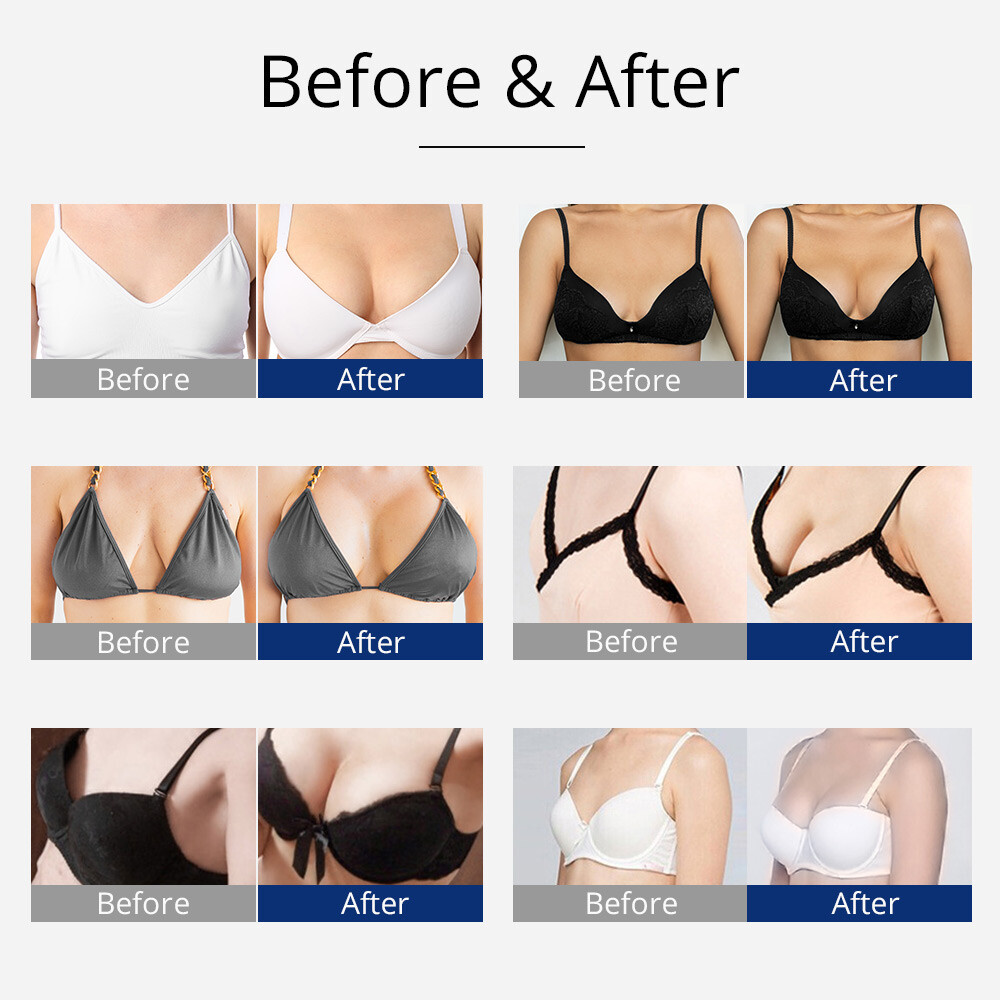150ml Breast Enlargement Butt Lift Lymph Detox Massage Cupping Therapy Machine