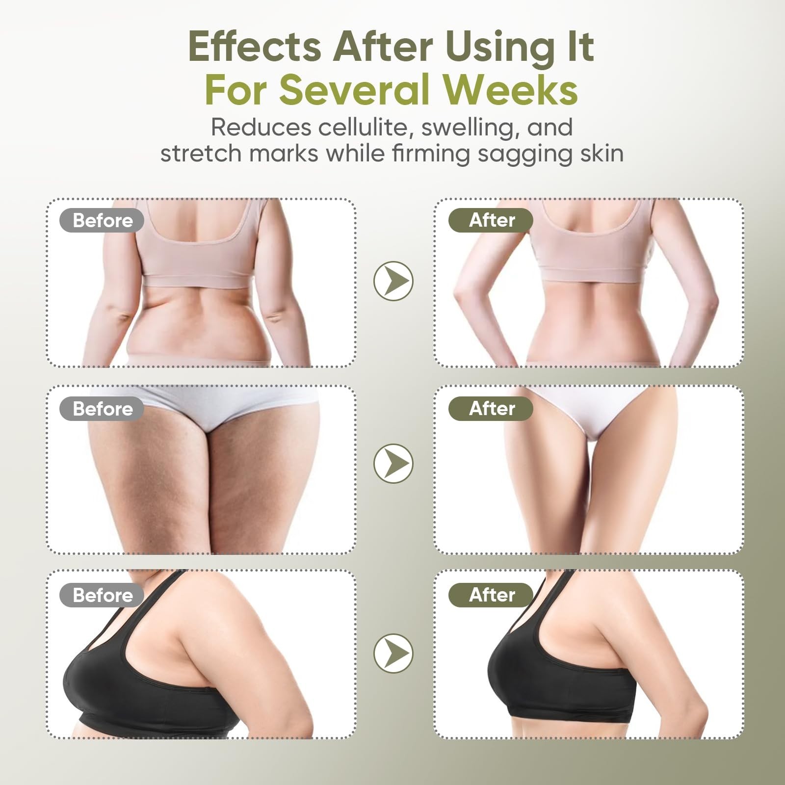 Lymphatic Drainage Massager, Anti Cellulite Body Sculpting Tool for Legs & Belly