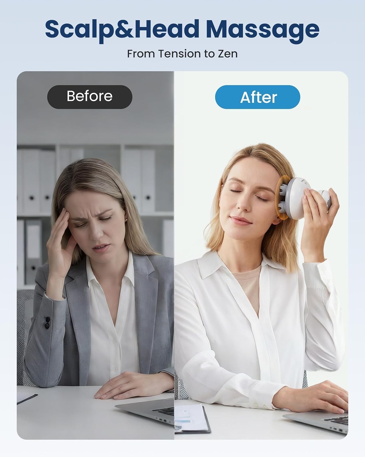 Handheld Scalp Massager for Hair Growth – 4 Mode Settings
