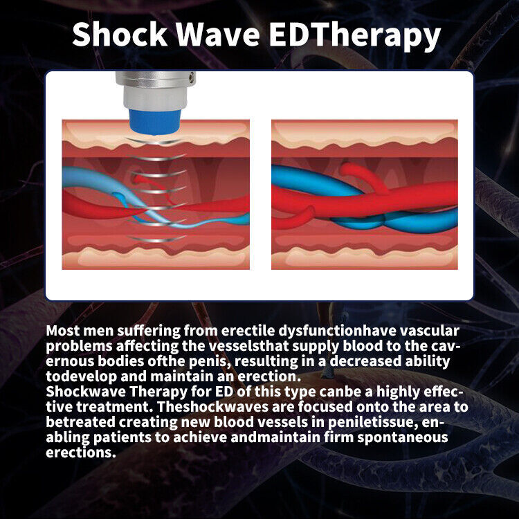 ED shock wave therapy machine for pain relief in the treatment