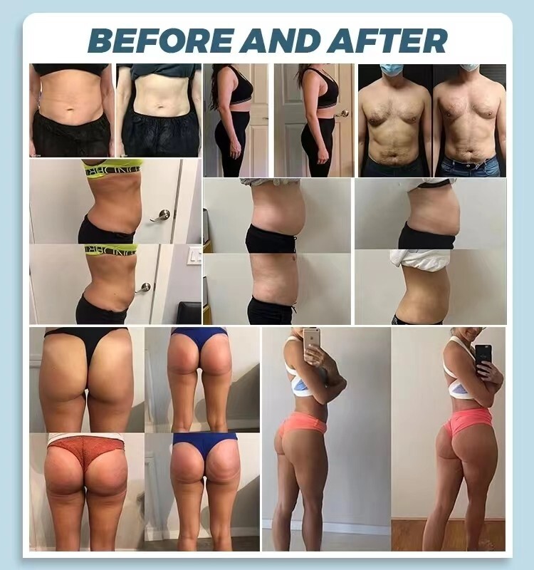 MYOslim Body Shaping Machine Muscle Stimulation Fat Removal Hip Lifting Device