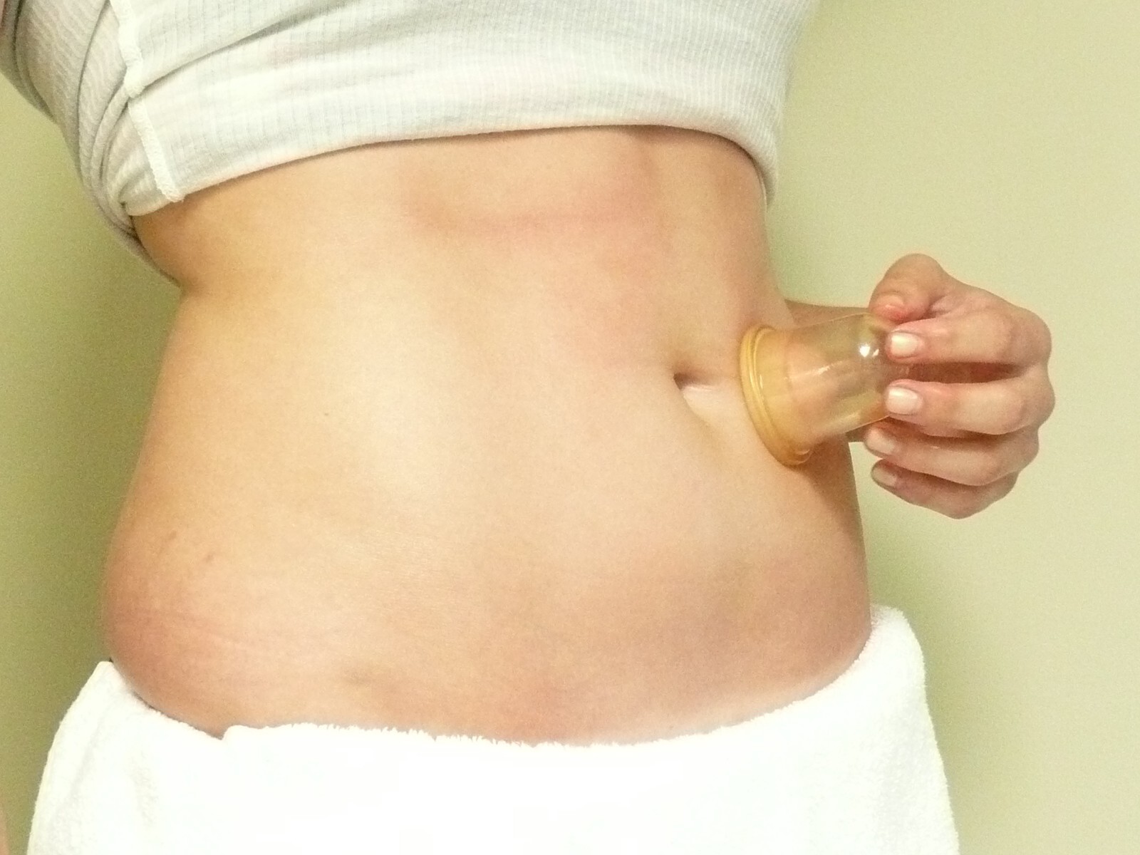 Set of 2 Anti-Cellulite Cups Cupping for Professional or Home Use