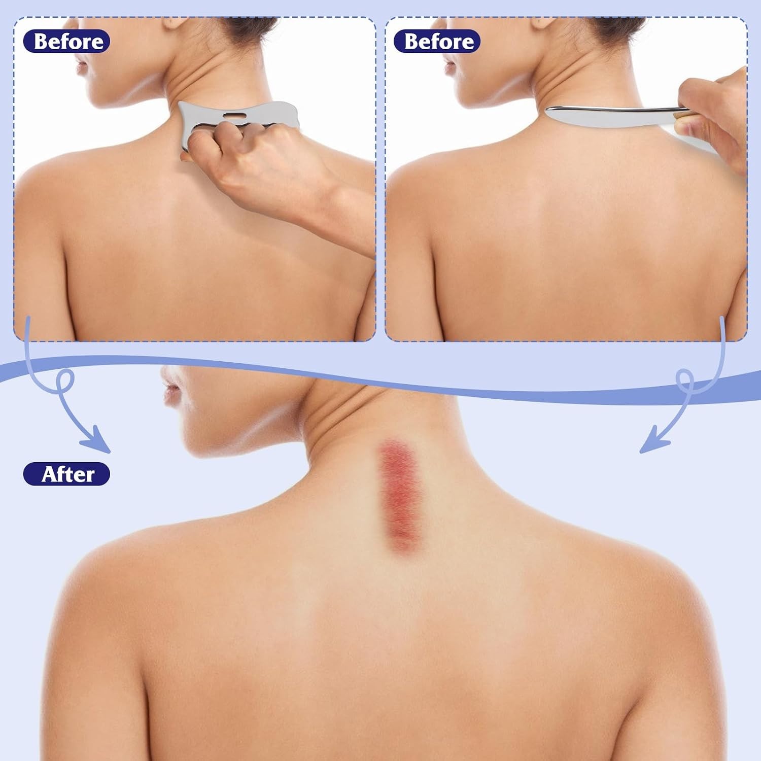 Optimal Soft Tissue Recovery Tool: Stainless Steel Gua Sha Massager for Home Use