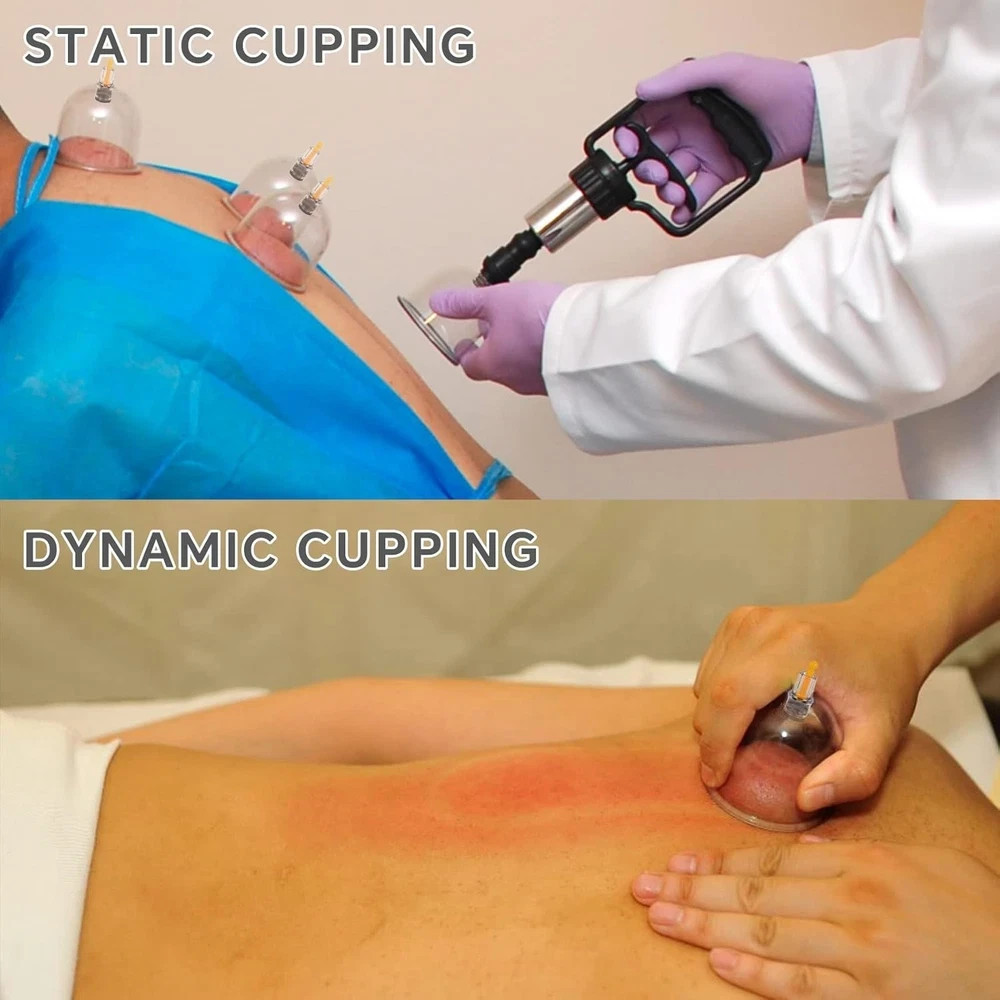 Cupping Therapy Massage Kit w Pump 12 Cups for Cellulite Muscle