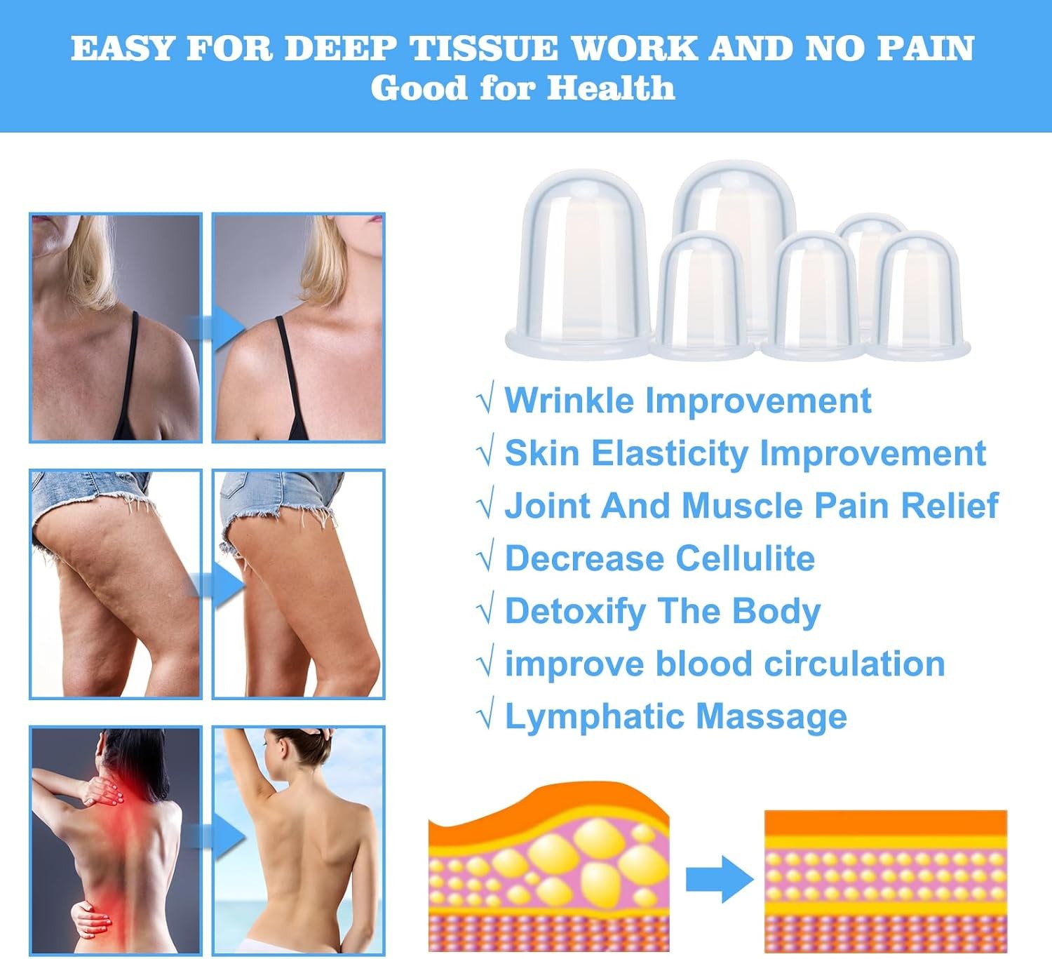 Silicone Cupping Therapy Set for Massage, Cellulite & Muscle Relief