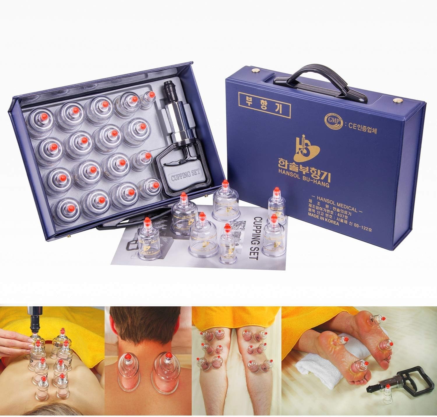 Easy-to-Use Cupping Equipment Set Made in Korea