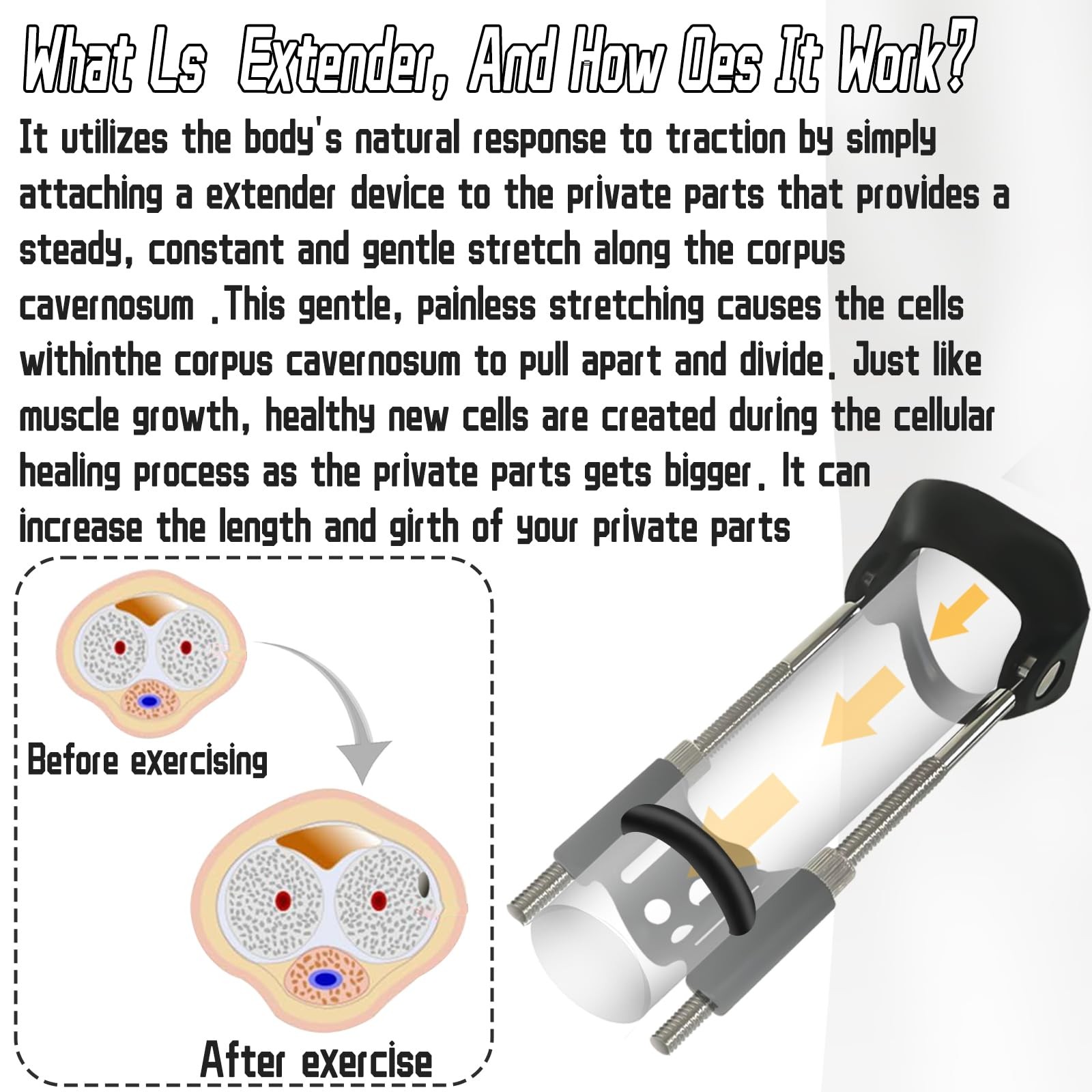 «Adjustable Male Extender Kit for Traction Training and Enlargement»
