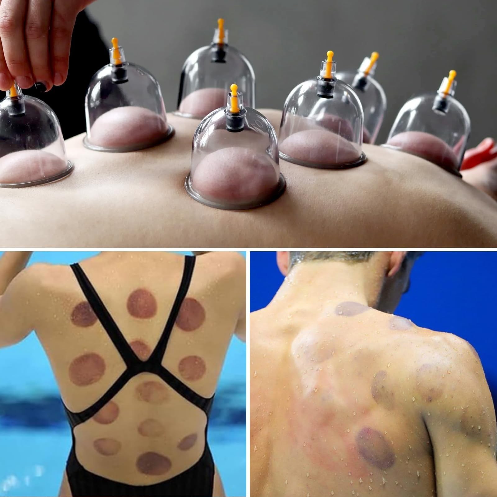 Professional Cupping Therapy Kit – 32 Magnetic Cups, Vacuum Set for Muscle Pain