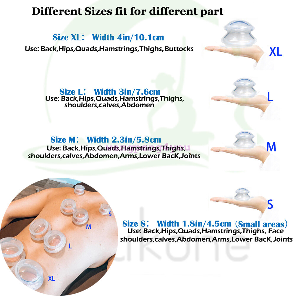 Koukone 4pc SILICONE CUPPING JAR CELLULITE THERAPY MASSAGE ACUPUNCTURE Kit CUPS