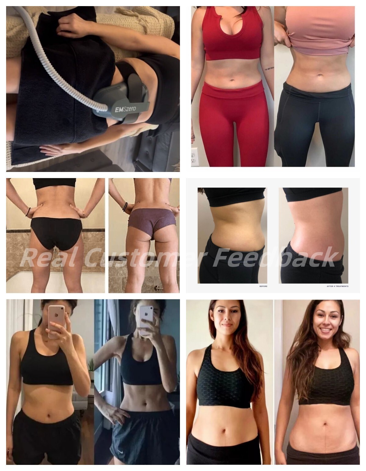 MYOslim Body Shaping Machine Muscle Stimulation Fat Removal Hip Lifting Device
