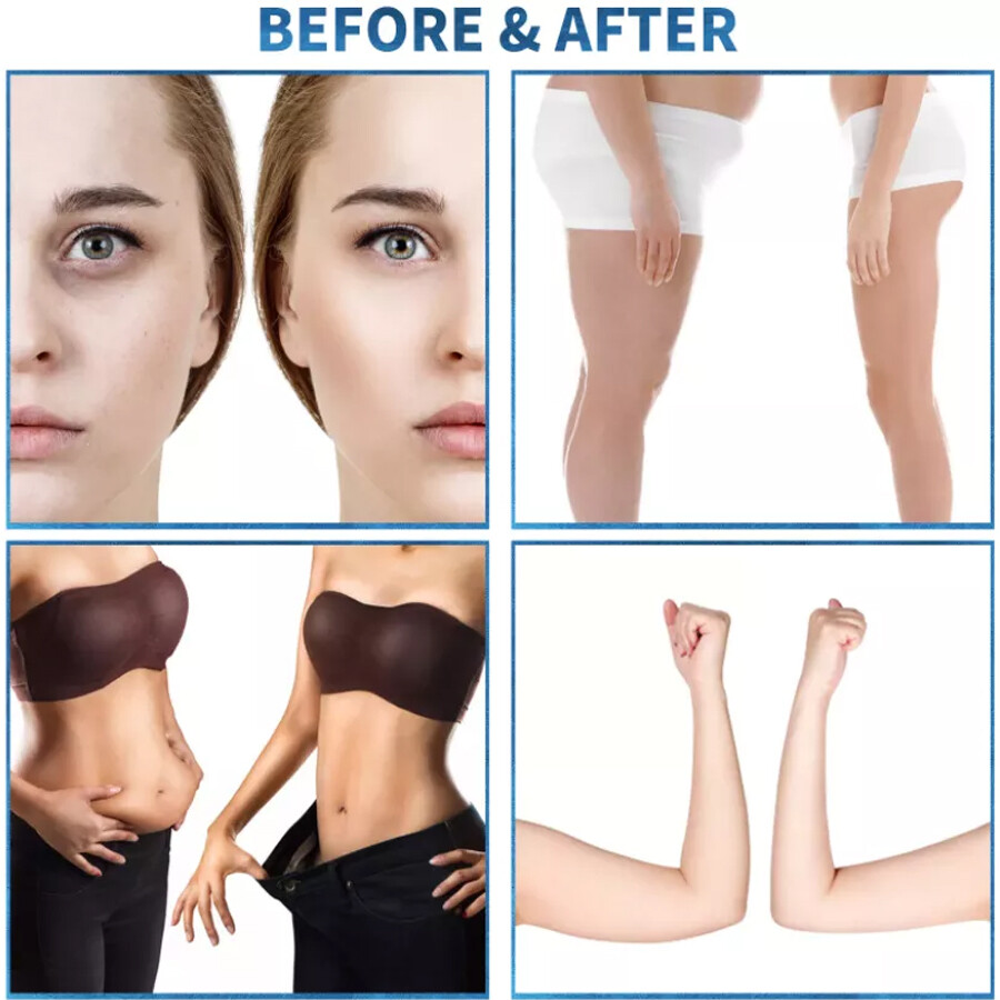 Body Endosphere Sculpting ROLLER Machine Loss Weight Lymphatic Drainage Massage