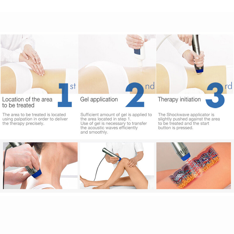 Shockwave Physiotherapy Machine ED Erectile Dysfunction Treatment Massage Relief